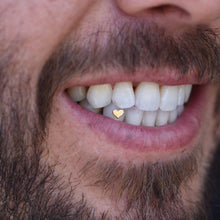 Load image into Gallery viewer, Tooth Gem Appointment